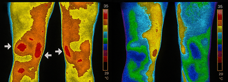 Thermal Before After
